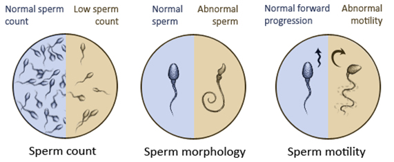 Diagnostic Investigation of Male Partner Diagnostic Investigation of Male Partner