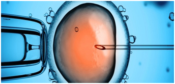 Intracytoplasmic Sperm Injection (ICSI)